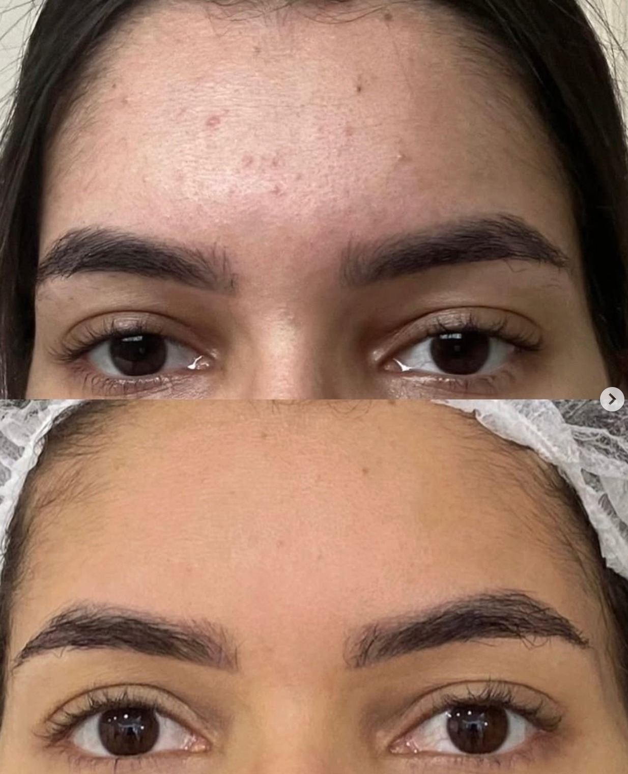 Antes y después - resultado 2