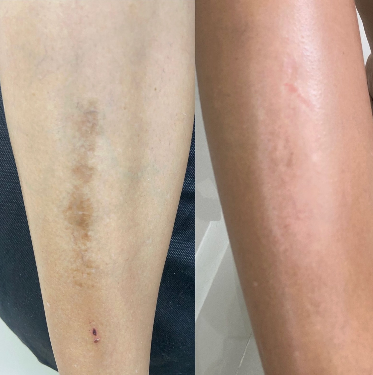 Antes y después - resultado 5
